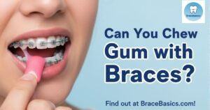 Can You Chew Gum with Braces?