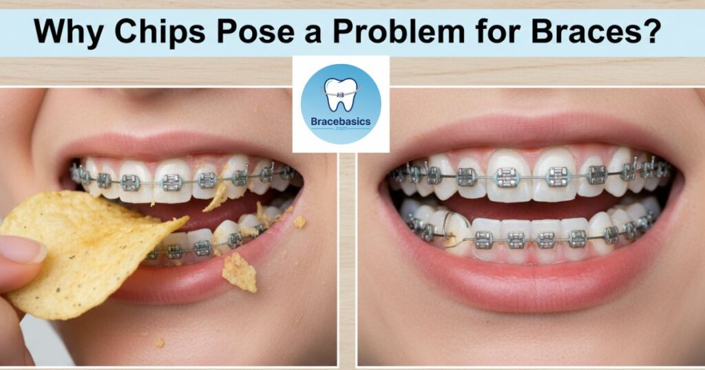 Why Chips Pose a Problem for Braces?