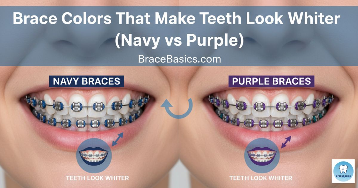 What Color Braces Should I Get? A Complete Guide to Choosing the Right ...