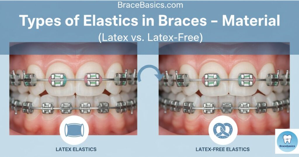 types-of-elastics-in-braces-material