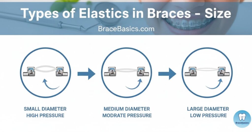 types-of-elastics-in-braces-size