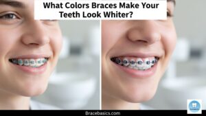 what-colors-braces-make-your-teeth-look-whiter-5-best-choices-for-stunning-results